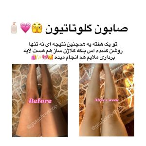 پکیج مکمل و صابون گلوتاتیون رفع تیرگی و سفید کننده